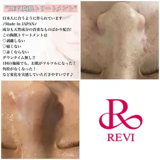 REVI取扱・肌悩み 毛穴Chalonのエステ・リラクイメージ
