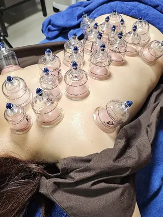 鍼灸整体院アレンジ所属・鍼灸整体院 アレンジのその他イメージ