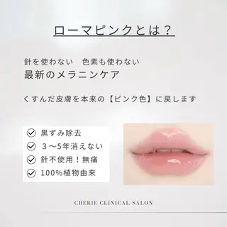 Raviy 【痩身専門・肌管理】のエステ・リラクイメージ