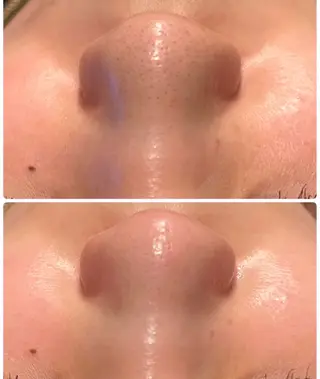 VlewQLO🌻 Natsumiのエステ・リラクイメージ