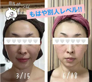 35歳からの エイジングケアサロンのエステ・リラクイメージ