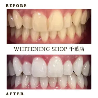 メンズ ホワイトニング ショップ千葉店のその他イメージ