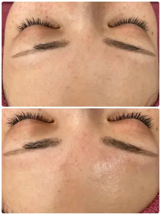 Chalon所属・REVI取扱・肌悩み 毛穴Chalonのエステ・リラクイメージ