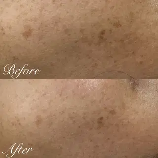 シミ🩷ニキビ専門店 Matteo🎀✨のエステ・リラクイメージ