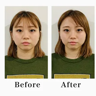 堀之内宏次 ［美容鍼灸師］のエステ・リラクイメージ