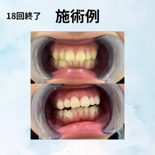 Ocpis博多店ホワイトニングサロン所属・ホワイトニングサロン Ocpis品川 慶仁のその他イメージ