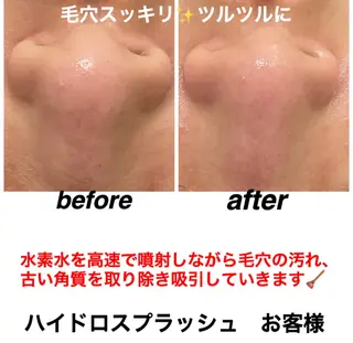 ネイル・エステサロン UILANIのネイルデザイン