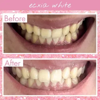 セルフホワイトニング エクシア町田店のその他イメージ