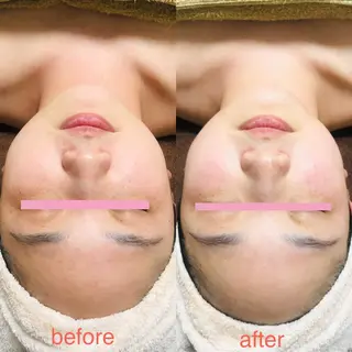 Lunon 【ルノン】のエステ・リラクイメージ