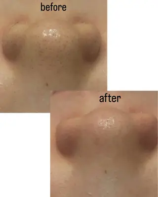 菊地 そらのエステ・リラクイメージ