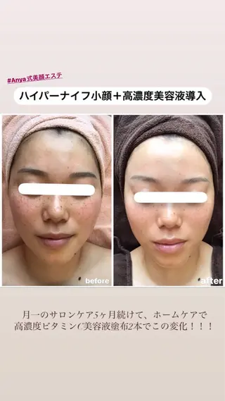 Anya Beautyのエステ・リラクイメージ