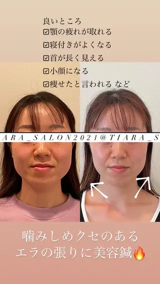 ミディアム カラー パーマ ヘアアレンジ メンズ キッズ ネイル マツエク・マツパ アイブロウ 鍼灸サロン TIARA　美容鍼のエステ・リラクイメージ