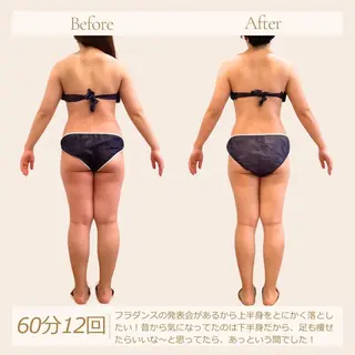 むくみ専門痩身 マクイエステティックのエステ・リラクイメージ