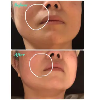 横浜石川町 こりケア 専門lala mouのエステ・リラクイメージ