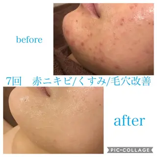 セミロング カラー パーマ ヘアアレンジ メンズ ネイル マツエク・マツパ EnsorClair 代表 野口真央のエステ・リラクイメージ