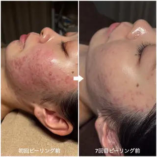 韓国肌管理×毛穴 改善専門🤍nanaのエステ・リラクイメージ