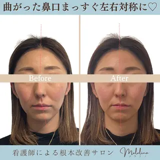 美容整体サロン Melalinoのエステ・リラクイメージ