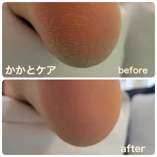 東京巻き爪 アカデミーのエステ・リラクイメージ