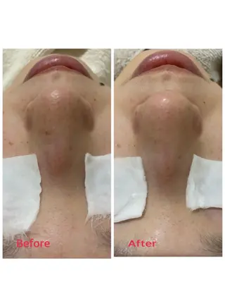 ポアレスサロン フィルのエステ・リラクイメージ