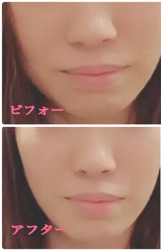 小顔サロン ソ.ルシエのエステ・リラクイメージ