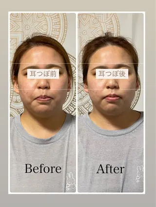 あだち整体エステ 首肩背中のゆるめぐのエステ・リラクイメージ