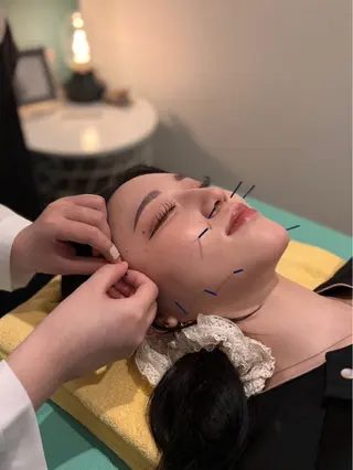 nano.face名古屋駅前店所属・美容鍼/小顔&整体 nano.faceのエステ・リラクイメージ