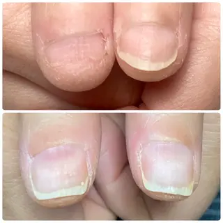 ネイル 自爪育成nail fachuriのネイルデザイン