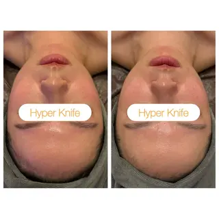 小顔コルギ ☆表参道/外苑前のエステ・リラクイメージ