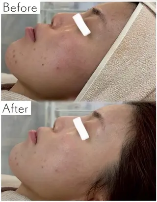 Liber【リベル】 AYAKAのエステ・リラクイメージ