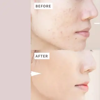 Re.dahlia 💠Harukaのエステ・リラクイメージ