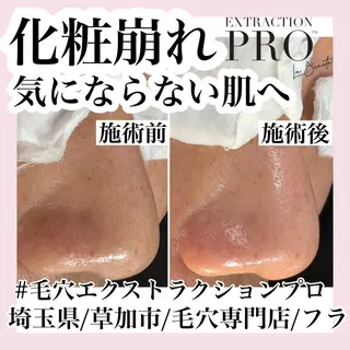 毛穴専門店hula 杉山智美のエステ・リラクイメージ