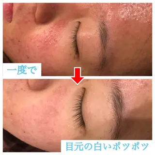 セミロング カラー パーマ ヘアアレンジ メンズ キッズ ネイル マツエク・マツパ 金の糸脱毛 産毛ケア専門のエステ・リラクイメージ