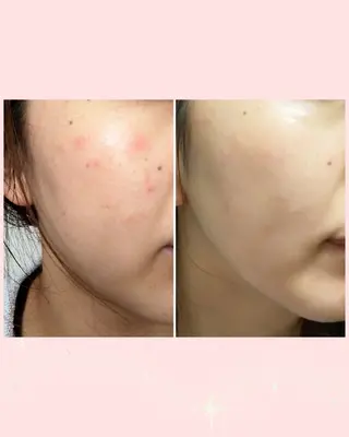 【エイジングケア肌質改善フェイシャル専門】Thanq-サンク-所属・サンク 飯田（イイダ）のエステ・リラクイメージ