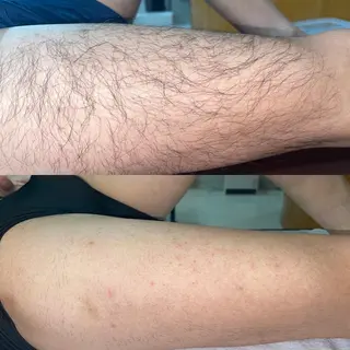 LANA所属・エステサロン LANA.のエステ・リラクイメージ