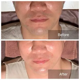 実村💚BLEZE 毛穴/脱毛/痩身のエステ・リラクイメージ