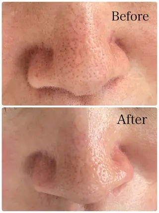 Salon de me'reのエステ・リラクイメージ