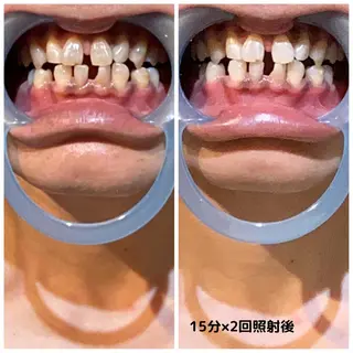 men's脱毛サロン ECXIAのエステ・リラクイメージ