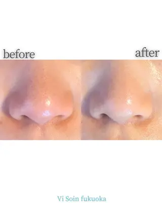 ソワン所属・脱毛 フェイシャル soin～ソワン～のエステ・リラクイメージ