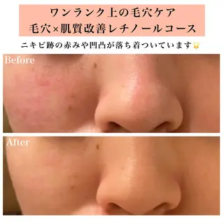 Bellesthe (ベルエステ)のエステ・リラクイメージ