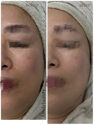 Amily beauty 毛利のエステ・リラクイメージ