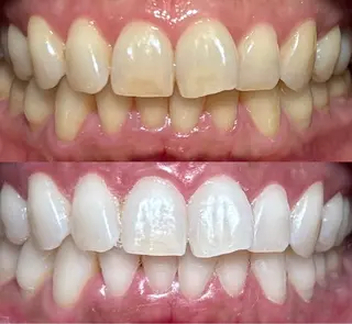 io teeth careのその他イメージ