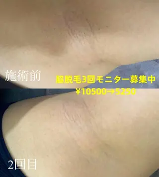 きよら ビューティーラウンジのエステ・リラクイメージ