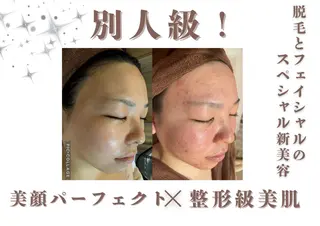 🎀美肌ケアサロン 🎀レイビス銀座店のエステ・リラクイメージ