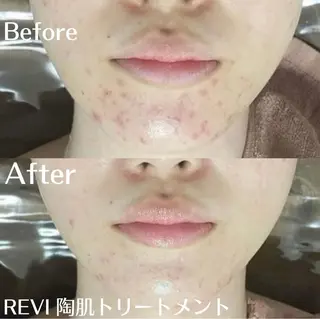 中目黒ハーブピーリン グ🌿ララピールのエステ・リラクイメージ