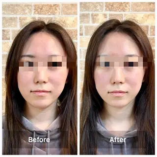 鍼灸HARIKARA所属・鍼灸 ハリカラのエステ・リラクイメージ