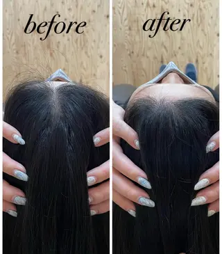 個室ドライヘッドスパ 🍃moriのエステ・リラクイメージ