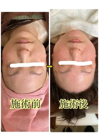 リンパケア&アロマケアサロンvigorans所属・西田 美恵子のエステ・リラクイメージ