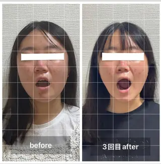 エクラヴィ 小顔・エイジングケアのエステ・リラクイメージ