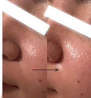 UEDA | POLA 天王寺のエステ・リラクイメージ