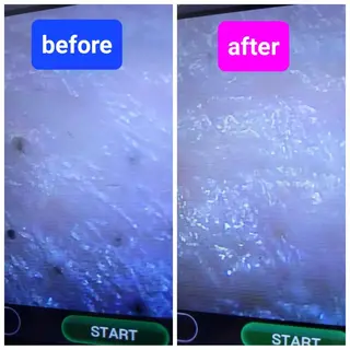 小顔/毛穴/肌質改善 💆セラピエージのエステ・リラクイメージ